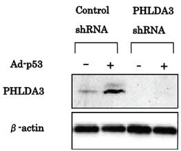 Anti-PHLDA3 Rat Monoclonal Antibody [clone: 4B6]