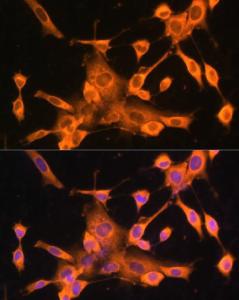 Immunofluorescence analysis of NIH-3T3 cells using Anti-FOXO3A Antibody (A11106) at dilution of 100 (40x lens) DAPI was used to stain the cell nuclei (blue)