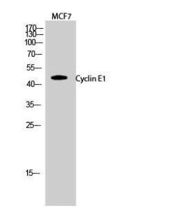 Anti-Cyclin E1 Rabbit Polyclonal Antibody