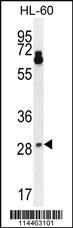 Anti-NTF3 Rabbit Polyclonal Antibody