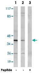 Anti-NT5C1A Rabbit Polyclonal Antibody