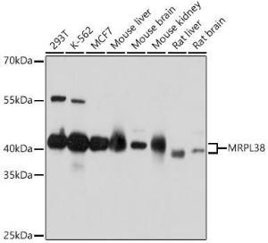 Western blot analysis of extracts of various cell lines, using Anti-MRPL38 Antibody (A307627) at 1:1,000 dilution. The secondary antibody was Goat Anti-Rabbit IgG H&L Antibody (HRP) at 1:10,000 dilution.