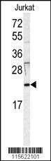 Anti-HRAS Rabbit Polyclonal Antibody