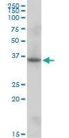 Anti-SNAPC1 Mouse Polyclonal Antibody