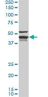 Anti-DNAJA4 Mouse Monoclonal Antibody [clone: 4B4-1F2]