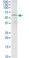 Anti-CHEK2 Rabbit Polyclonal Antibody