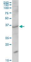 Anti-SNAPC1 Mouse Polyclonal Antibody