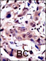 Anti-MUSK Rabbit Polyclonal Antibody (HRP (Horseradish Peroxidase))