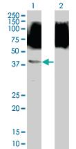 Anti-SNAPC1 Mouse Polyclonal Antibody