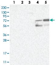 Anti-CACNA2D4 Rabbit Polyclonal Antibody