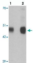 Anti-RILPL1 Rabbit Polyclonal Antibody