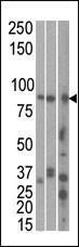 Anti-MARK1 Rabbit Polyclonal Antibody (FITC (Fluorescein Isothiocyanate))