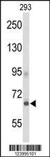 Anti-GPR133 Rabbit Polyclonal Antibody