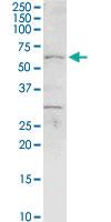 Anti-CHEK2 Rabbit Polyclonal Antibody