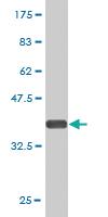 Anti-RAB9B Mouse Monoclonal Antibody [clone: 3C9]