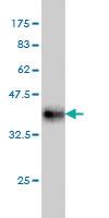 Anti-MAP4K4 Mouse Monoclonal Antibody [clone: 4A5]