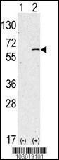 Anti-SPHK1 Rabbit Polyclonal Antibody