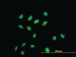 Anti-CDYL Mouse Monoclonal Antibody [clone: 1A6]