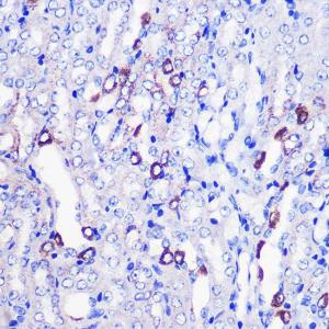 Immunohistochemistry analysis of paraffin-embedded mouse kidney using Anti-MRPL38 Antibody (A307627) at a dilution of 1:100 (40x lens)