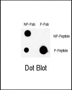 Anti-BRAF Rabbit Polyclonal Antibody (Biotin)