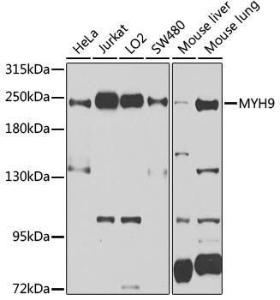 Western blot analysis of extracts of various cell lines, using Anti-non-muscle Myosin IIA Antibody (A11122) at 1:1000 dilution