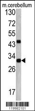 Anti-ZWINT Rabbit Polyclonal Antibody