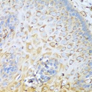 Immunohistochemistry analysis of paraffin-embedded human esophagus using Anti-non-muscle Myosin IIA Antibody (A11122) at a dilution of 1:100 (40x lens)