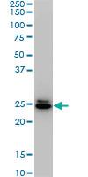 Anti-HMGB2 Mouse Monoclonal Antibody [clone: 4G7]