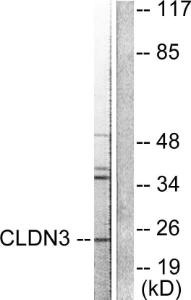 Western blot analysis of lysates from HUVEC cells using Anti-Claudin 3 Antibody. The right hand lane represents a negative control, where the antibody is blocked by the immunising peptide.