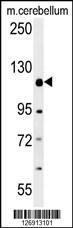 Anti-RADIL Rabbit Polyclonal Antibody