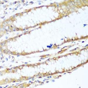 Immunohistochemistry analysis of paraffin-embedded human stomach using Anti-non-muscle Myosin IIA Antibody (A11122) at a dilution of 1:100 (40x lens). Perform microwave antigen retrieval with 10 mM PBS buffer pH 7.2 before commencing with IHC staining protocol