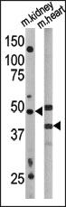 Anti-ATG4A Rabbit Polyclonal Antibody