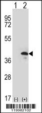 Anti-ZWINT Rabbit Polyclonal Antibody