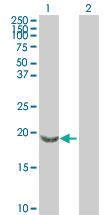 Anti-SNCB Mouse Polyclonal Antibody