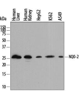 Anti-NQO-2 Sheep Polyclonal Antibody