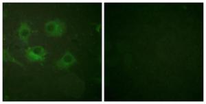 Immunofluorescence analysis of HUVEC cells using Anti-Claudin 3 Antibody. The right hand panel represents a negative control, where the antibody was pre-incubated with the immunising peptide.