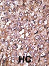 Anti-ATG4A Rabbit Polyclonal Antibody