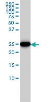 Anti-HMGB2 Mouse Monoclonal Antibody [clone: 4G7]