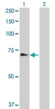 Anti-CHEK2 Rabbit Polyclonal Antibody