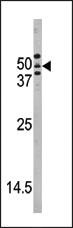 Anti-ATG4A Rabbit Polyclonal Antibody