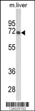 Anti-GBE1 Rabbit Polyclonal Antibody