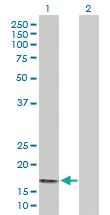 Anti-PPP3R2 Rabbit Polyclonal Antibody