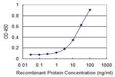 Anti-CDYL Mouse Monoclonal Antibody [clone: 1A6]