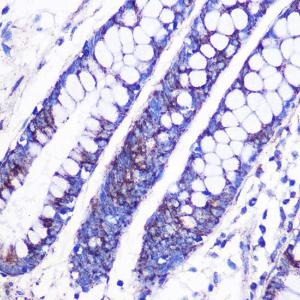 Immunohistochemistry analysis of paraffin-embedded human colon tissue using Anti-MRPL38 Antibody (A307627) at a dilution of 1:100 (40x lens)