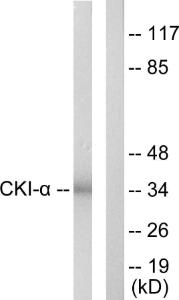 Western blot analysis of lysates from HeLa cells using Anti-CKI-alpha Antibody. The right hand lane represents a negative control, where the Antibody is blocked by the immunising peptide