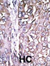 Anti-ATG4A Rabbit Polyclonal Antibody