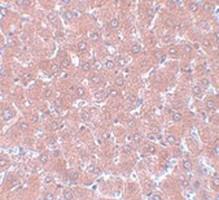 Anti-WDR74 Rabbit Polyclonal Antibody