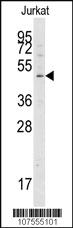 Anti-ATG4A Rabbit Polyclonal Antibody