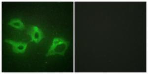 Immunofluorescence analysis of HeLa cells using Anti-CKI-alpha Antibody. The right hand panel represents a negative control, where the Antibody was pre-incubated with the immunising peptide