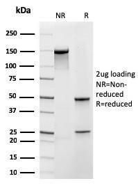 SDS-PAGE analysis of Anti-Frataxin Antibody [rFXN/2124] under non-reduced and reduced conditions; showing intact IgG and intact heavy and light chains, respectively. SDS-PAGE analysis confirms the integrity and purity of the antibody.